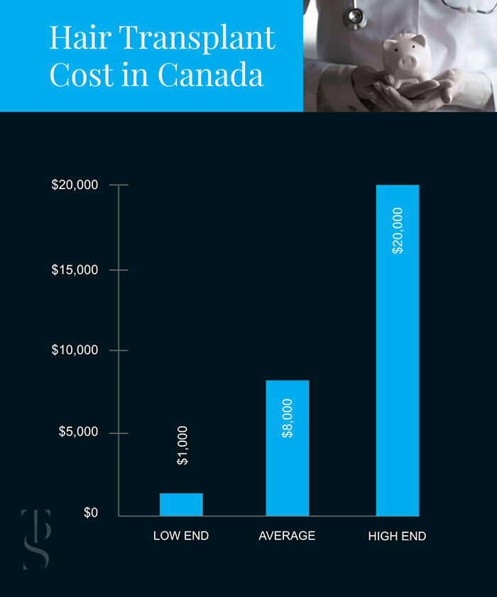 Cost of a Hair Transplant in Canada table