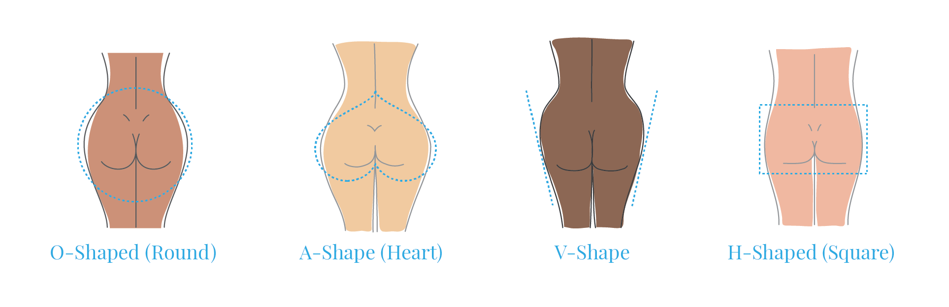 four common types of butt