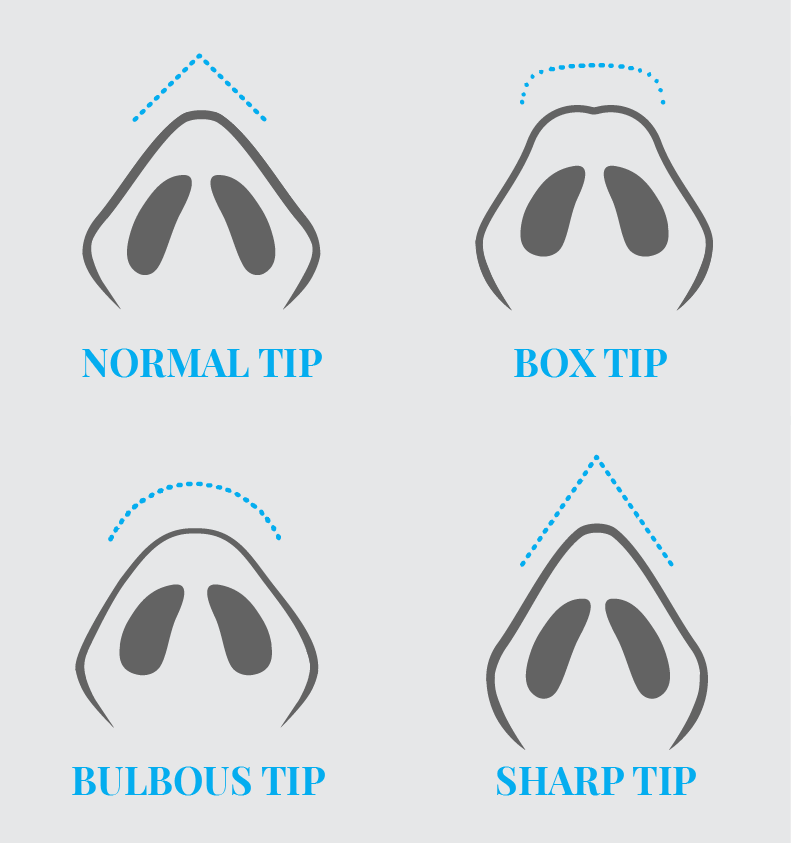 Different types of nasal tips